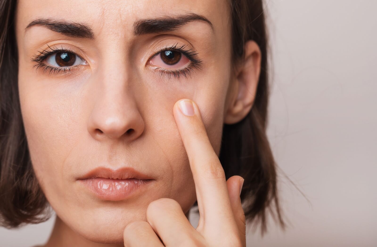 A patient with a red and irritated eye.